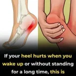 7 effective exercises to reduce heel pain and manage plantar fasciitis naturally